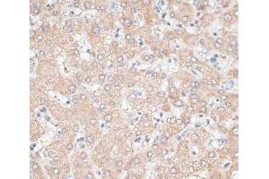 Immunohistochemistry of paraffin-embedded Human liver using GPC3 Polyclonal Antibody at dilution of 1:100 (40x lens). (Glypican 3 抗体)