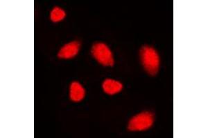Immunofluorescent analysis of MUTYH staining in K562 cells. (MUTYH 抗体  (Center))