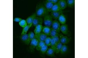 IF analysis of PPFIA1 using anti-PPFIA1 antibody (ABIN7600454).