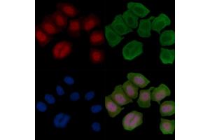 ABIN6255742 and ABIN6266454 staining Hela cells(45 min of heat-shock treatment) by IF/ICC. (Retinoblastoma Protein (Rb) 抗体  (pThr826))