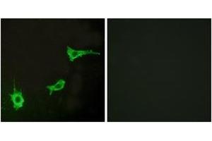 Immunofluorescence analysis of LOVO cells, using EDNRA Antibody. (Endothelin-1 Receptor 抗体  (AA 378-427))