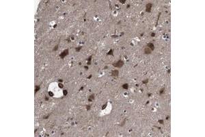 Immunohistochemical staining of human cerebral cortex with PAWR polyclonal antibody  shows strong cytoplasmic and nuclear positivity in neuronal cells and glial cells at 1:50-1:200 dilution. (PAWR 抗体)
