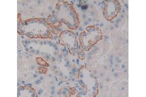 Immunohistochemistry (IHC) image for anti-Solute Carrier Family 12 (Potassium-Chloride Transporter) Member 7 (SLC12A7) (AA 845-1056) antibody (ABIN1868808)