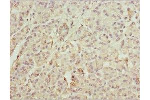 Immunohistochemistry of paraffin-embedded human pancreatic tissue using ABIN7176057 at dilution of 1:100 (ZFYVE1 抗体  (AA 1-280))