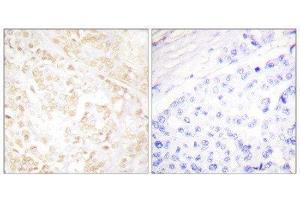Immunohistochemistry (IHC) image for anti-X-Ray Repair Complementing Defective Repair in Chinese Hamster Cells 6 (XRCC6) (C-Term) antibody (ABIN1848905) (XRCC6 抗体  (C-Term))
