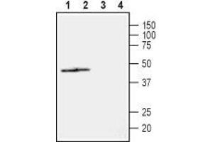 NIPA2 抗体  (2nd Extracellular Loop)