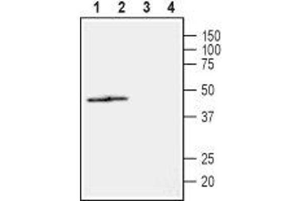 NIPA2 抗体  (2nd Extracellular Loop)