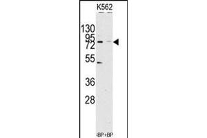 Western blot analysis of anti-JHDM1a/FBXL11 Antibody pre-incubated with(right lane) and without(left lane) blocking peptide in Jurkat cell line lysate. (KDM2A 抗体  (C-Term))