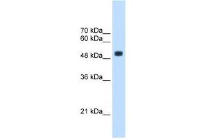 WB Suggested Anti-CXorf34 Antibody Titration:  2. (TRMT2B 抗体  (Middle Region))