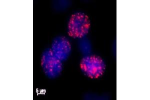 Histone H2AX phospho Ser139 antibody tested by immunofluorescence. (H2AFX 抗体  (pSer139))