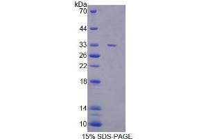 SDS-PAGE analysis of Mouse CASC5 Protein. (CASC5 蛋白)
