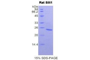 SDS-PAGE (SDS) image for Slit Homolog 1 (SLIT1) (AA 308-512) protein (His tag) (ABIN2122115) (SLIT1 Protein (AA 308-512) (His tag))