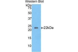 Western Blotting (WB) image for anti-Laminin, gamma 1 (LAMC1) (AA 1228-1404) antibody (ABIN1078267) (Laminin gamma 1 抗体  (AA 1228-1404))