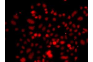 Immunofluorescence analysis of A549 cell using RRAGC antibody. (GTR2 抗体)
