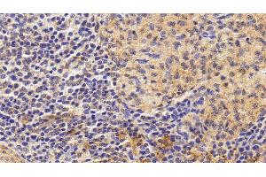 Detection of IL6 in Human Spleen Tissue using Monoclonal Antibody to Interleukin 6 (IL6) (IL-6 抗体  (AA 29-212))