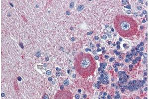 Human Brain, cerebellum: Formalin-Fixed, Paraffin-Embedded (FFPE) (GPR6 抗体  (N-Term))