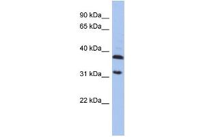 WB Suggested Anti-ASPA Antibody Titration: 0. (ASPA 抗体  (Middle Region))