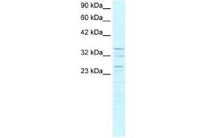 ZNF385 antibody used at 0. (ZNF385A 抗体  (C-Term))