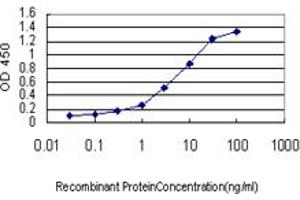 Detection limit for recombinant GST tagged IRAK3 is approximately 0. (IRAK3 抗体  (AA 497-596))