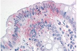 Human Colon: Formalin-Fixed, Paraffin-Embedded (FFPE) (NPTN 抗体  (N-Term))