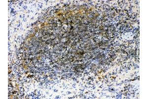 IHC analysis of GAS 6 using anti- GAS 6 antibody . (GAS6 抗体  (AA 488-660))
