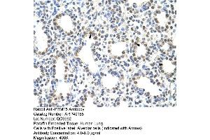 Rabbit Anti-PRMT5 Antibody  Paraffin Embedded Tissue: Human Lung Cellular Data: Alveolar cells Antibody Concentration: 4. (PRMT5 抗体  (N-Term))