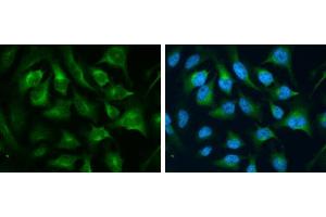 ICC/IF Image CD71 antibody [N2C1], Internal detects CD71 protein at cytoplasm by immunofluorescent analysis. (Transferrin Receptor 抗体)