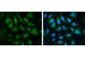 ICC/IF Image CD71 antibody [N2C1], Internal detects CD71 protein at cytoplasm by immunofluorescent analysis. (Transferrin Receptor 抗体)