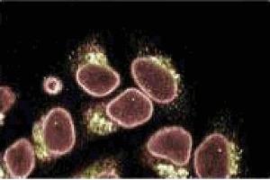 Immunofluorescence staining of HeLa cells (Human cervical epitheloid carcinoma, ATCC CCL-2). (Coilin 抗体  (AA 226-332))