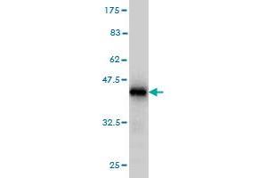 Western Blotting (WB) image for anti-Budding Uninhibited By Benzimidazoles 1 Homolog beta (Yeast) (BUB1B) (AA 1-130) antibody (ABIN560109)