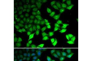 Immunofluorescence analysis of U2OS cells using KDM4B Polyclonal Antibody (KDM4B 抗体)