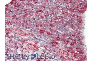 IHC-P analysis of Human Tonsil Tissue, with HE staining. (CD86 抗体  (AA 46-282))