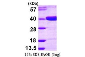 Aldo-Keto Reductase Family 1, Member D1 (AKR1D1) (AA 1-326) protein (His tag)