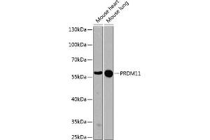 Western blot analysis of extracts of various cell lines, using PRDM11 antibody (ABIN6128494, ABIN6146129, ABIN6146131 and ABIN6224586) at 1:1000 dilution. (PRDM11 抗体  (AA 228-477))