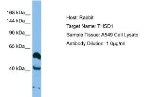 Host: Rabbit Target Name: THSD1 Sample Type: A549 Whole cell lysates Antibody Dilution: 1. (THSD1 抗体  (Middle Region))