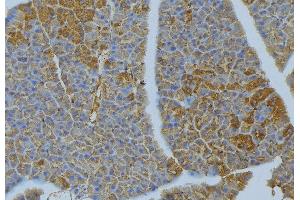 ABIN6277029 at 1/100 staining Human pancreas tissue by IHC-P. (CD70 抗体  (Internal Region))
