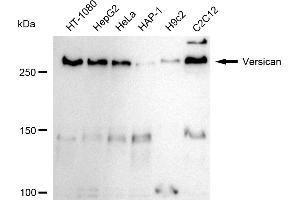 Western blotting analysis using Versican antibody (ABIN7800829).