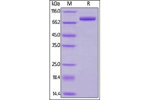 Cynomolgus Transferrin R, His Tag on  under reducing (R) condition.