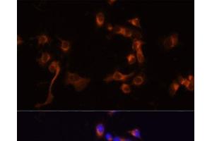 Immunofluorescence analysis of A431 cells using ABL1 Polyclonal Antibody at dilution of 1:100 (40x lens). (ABL1 抗体)