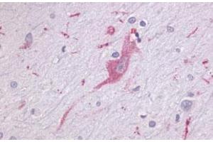 Immunohistochemical (Formalin/PFA-fixed paraffin-embedded sections) staining in human brain, neurons and glia with LPHN1 polyclonal antibody . (Latrophilin 1 抗体  (Extracellular Domain))