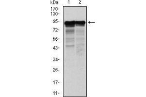 Western blot analysis using NEFL mouse mAb against Hela (1) and Jurkat (2) cell lysate. (NEFL 抗体)