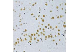 Immunohistochemistry of paraffin-embedded mouse brain using SNRNP70 antibody. (SNRNP70 抗体  (AA 150-250))