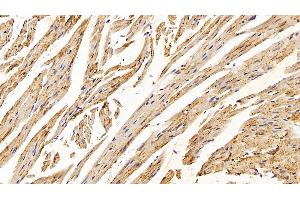 Detection of CAT in Mouse Cardiac Muscle Tissue using Polyclonal Antibody to Catalase (CAT)
