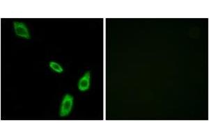 Immunofluorescence analysis of LOVO cells, using ADRA1B Antibody. (ADRA1B 抗体  (AA 431-480))