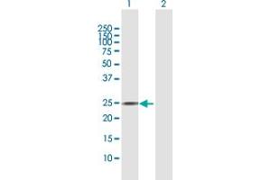 Western Blot analysis of AGPAT2 expression in transfected 293T cell line by AGPAT2 MaxPab polyclonal antibody. (AGPAT2 抗体  (AA 1-278))