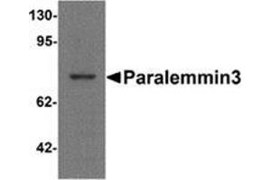 Western blot analysis of Paralemmin3 in MCF7 cell lysate with Paralemmin-3 Cat. (PALM3 抗体  (N-Term))