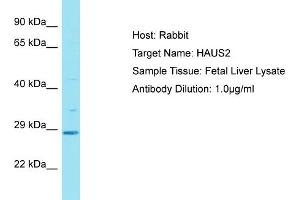 Host: Rabbit Target Name: HAUS2 Sample Tissue: Human Fetal Liver Antibody Dilution: 1ug/ml (HAUS2 抗体  (C-Term))