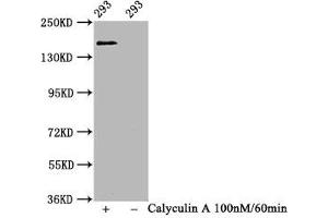 Western Blot Positive WB detected in 293 whole cell lysate(treated with Calyculin A or not) All lanes Phospho-SMC1A antibody at 1. (Recombinant SMC1A 抗体  (pSer957))