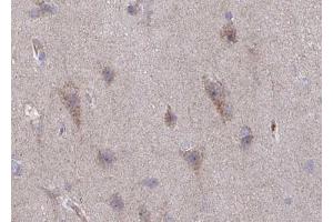 Immunohistochemistry (IHC) image for anti-Glutamate Receptor, Ionotropic, N-Methyl D-Aspartate 2B (GRIN2B) (pTyr1336) antibody (ABIN6256636)