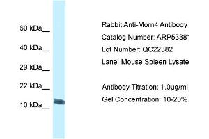 Western Blotting (WB) image for anti-MORN Repeat Containing 4 (MORN4) (C-Term) antibody (ABIN2785367) (MORN4 抗体  (C-Term))